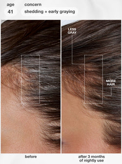 FutureIQ™ biomimetic hair longevity serum